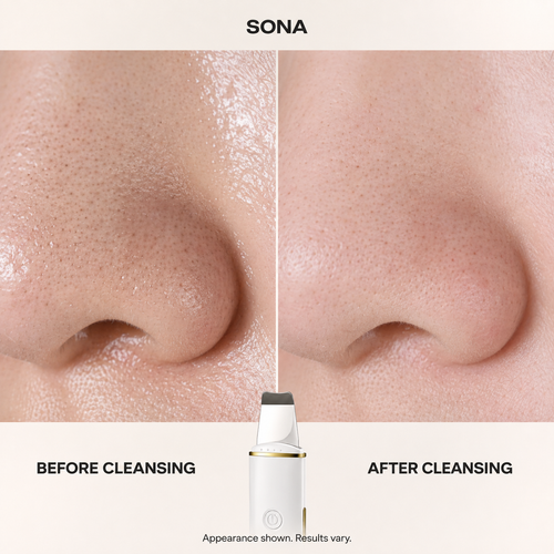 Close-up before and after cleansing appearance with SONA; results vary